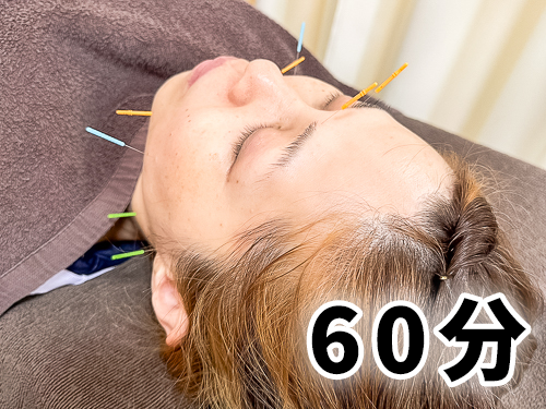 　美容鍼灸フルコース【約60分】
