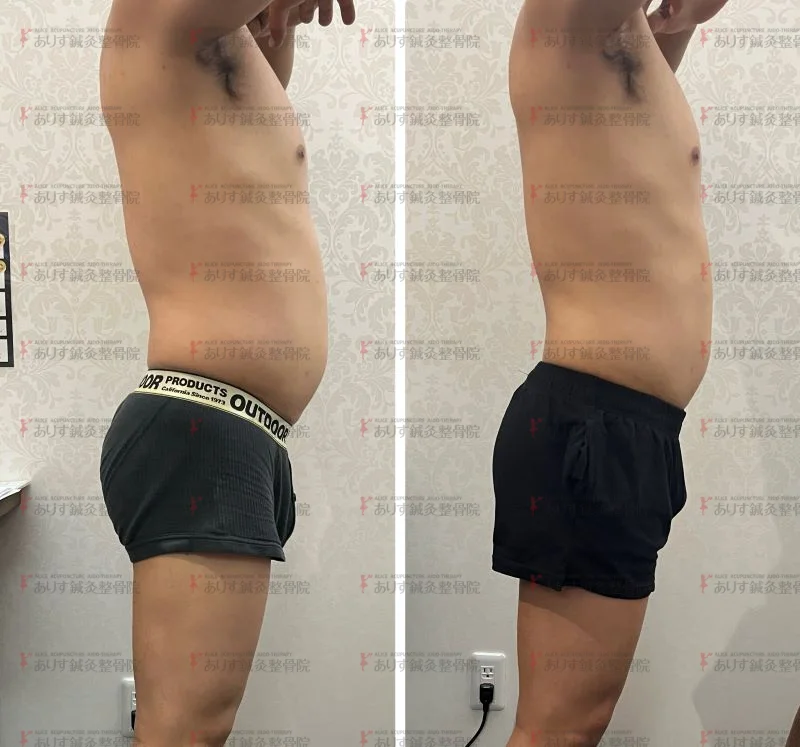 わずか20日後に－6cm！40代男性のダイエットも脂肪冷却でラク痩せ